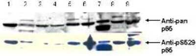 Western Blot: RelA/NFkB p65 [p Ser529] Antibody [NBP1-77808]